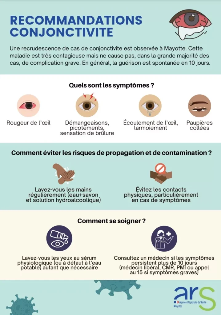 ARS, Mayotte, conjonctivite