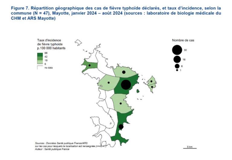 Santé Publique France, ARS, Mayotte, fièvre typhoïde, choléra, dengue,