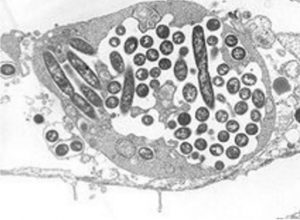 Legionella pneumophila, la bactérie responsable de la légionellose (Image: Wiki Commons)