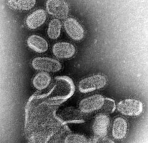 Virus de la grippe (Image: Wiki Commons)
