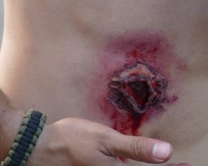 Un homme se tient le ventre... une blessure plus vraie que nature