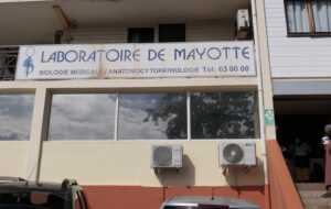 Mayotte, VIH, sida, laboratoire,