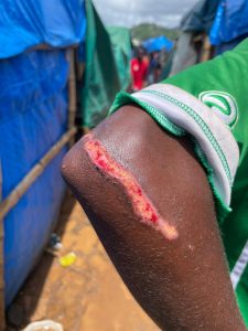 Tsoundzou, camp, exilés, Coallia, Mayotte